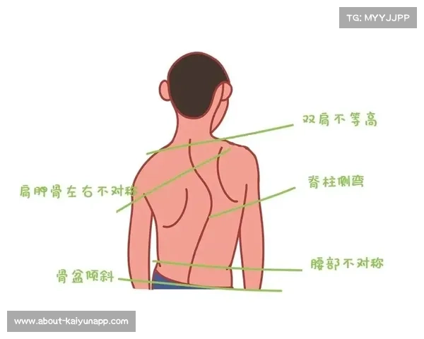 青少年训练过程中脊柱侧弯对球员职业生涯的严重影响及防治策略 青少年训练过程中脊柱侧弯对球员职业生涯的严重影响及防治策略